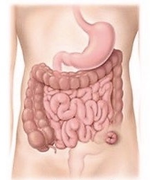 Colostomia