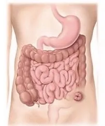 Colostomia